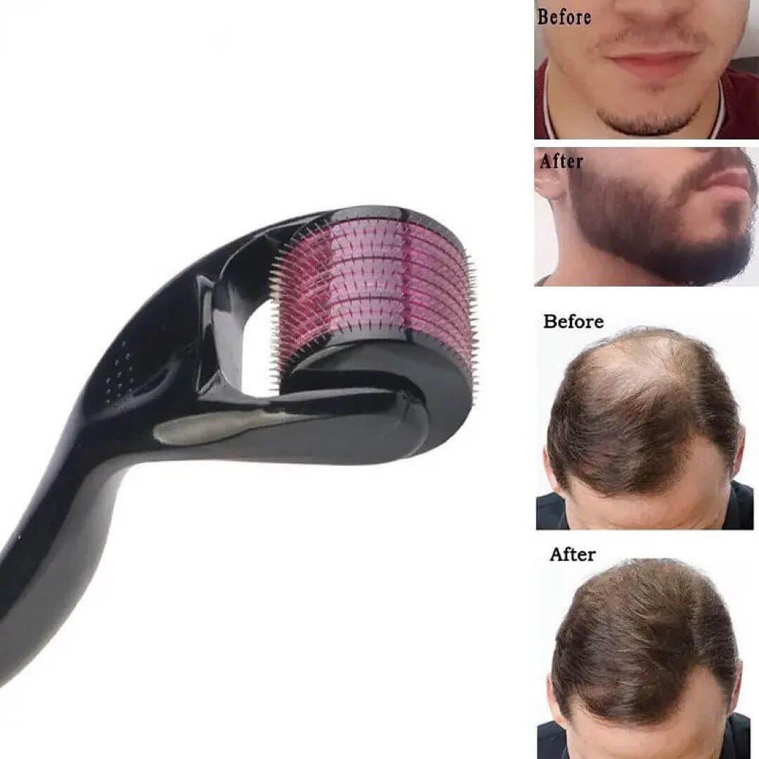 540 Needles Facial & Body Hair Growth Derma Roller Homzystore