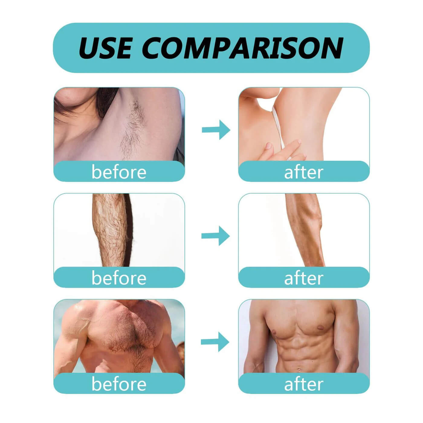 Ecrin Hair Removal Spray For Men & Women - 150ml Homzystore