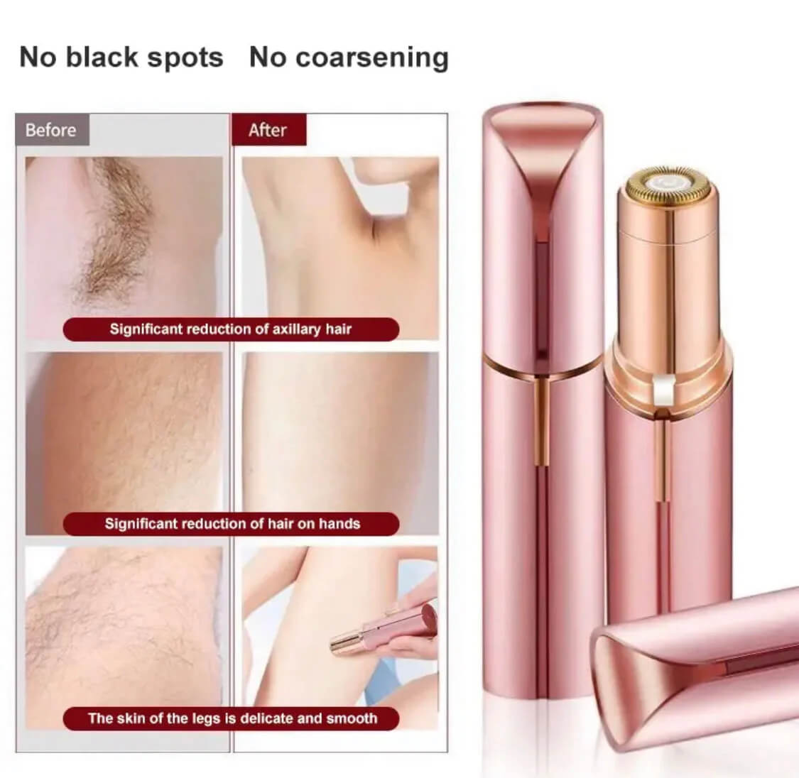 Facial Beauty - Flawless Facial Hair Removal Machine Homzystore