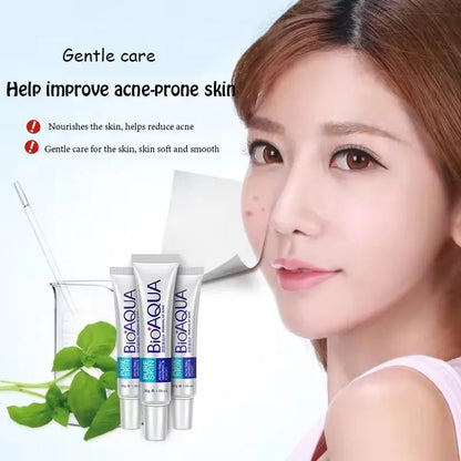 Bioaqua Acni cream Homzystore