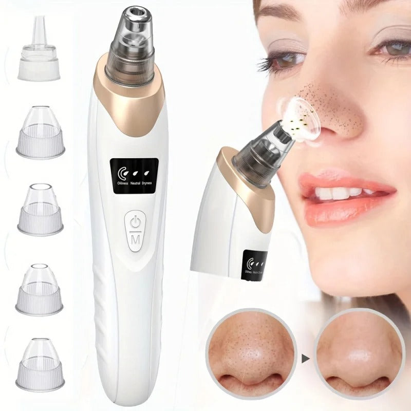 4 in 1 BlackHead Remover 8030 Homzystore