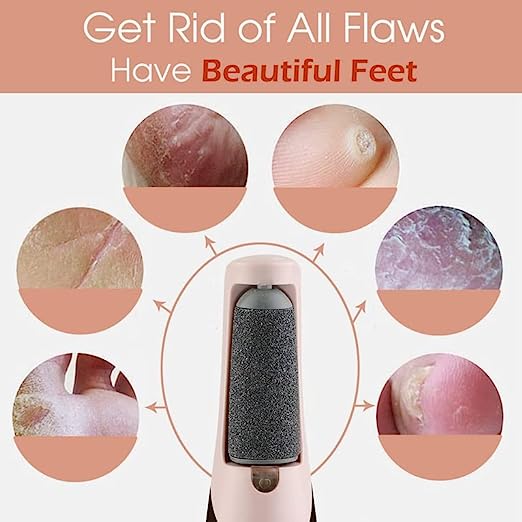 Dead Skin Removal Electronic Foot Filer Homzystore