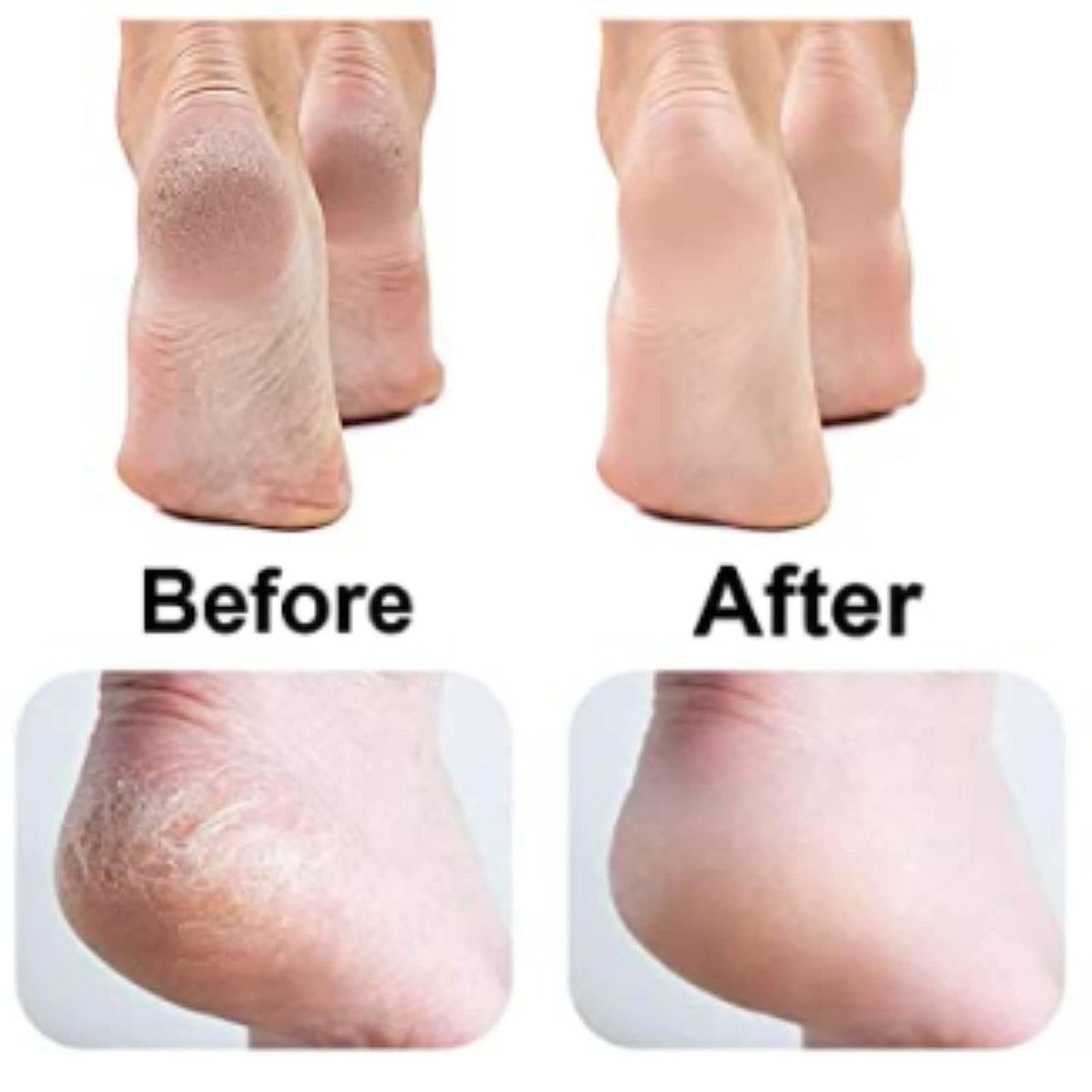 Dead Skin Removal Electronic Foot Filer Homzystore