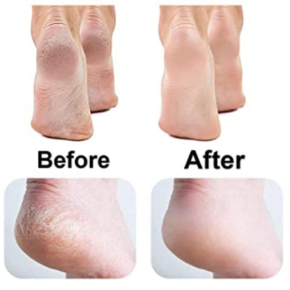 Dead Skin Removal Electronic Foot Filer Homzystore