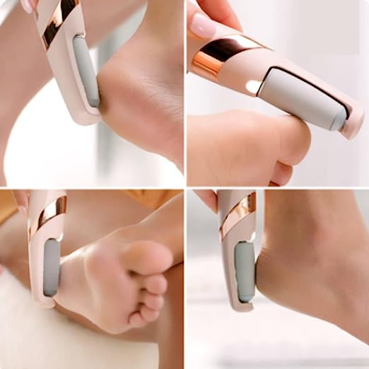 Dead Skin Removal Electronic Foot Filer Homzystore