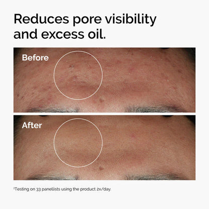 The Ordinary Niacinamide 10% + Zinc 1% Serum - 30ml Homzystore