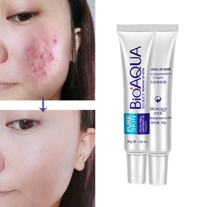 Bioaqua - Anti Acne Scar Removal Cream 30g Homzystore