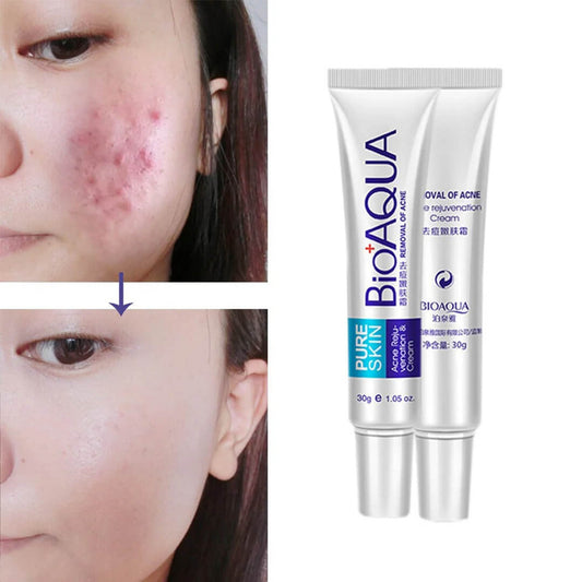 Bioaqua - Anti Acne Scar Removal Cream 30g Homzystore