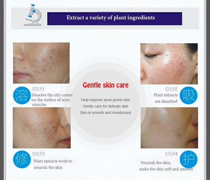 Bioaqua Acni cream Homzystore