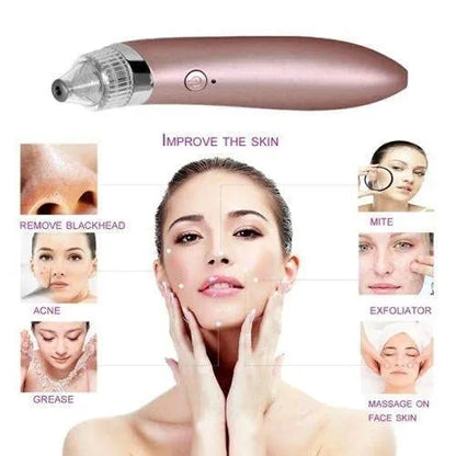 Black Head Remover Homzystore