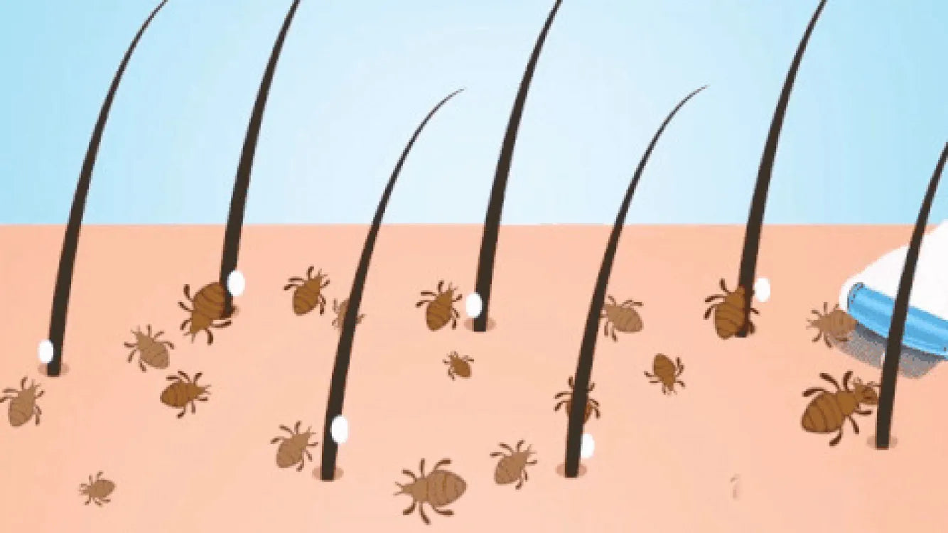 V- Comb Anti Lice Homzystore