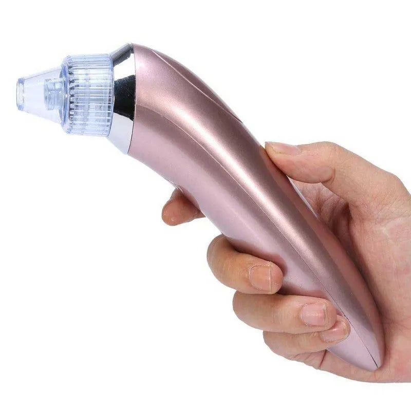 Black Head Remover Homzystore