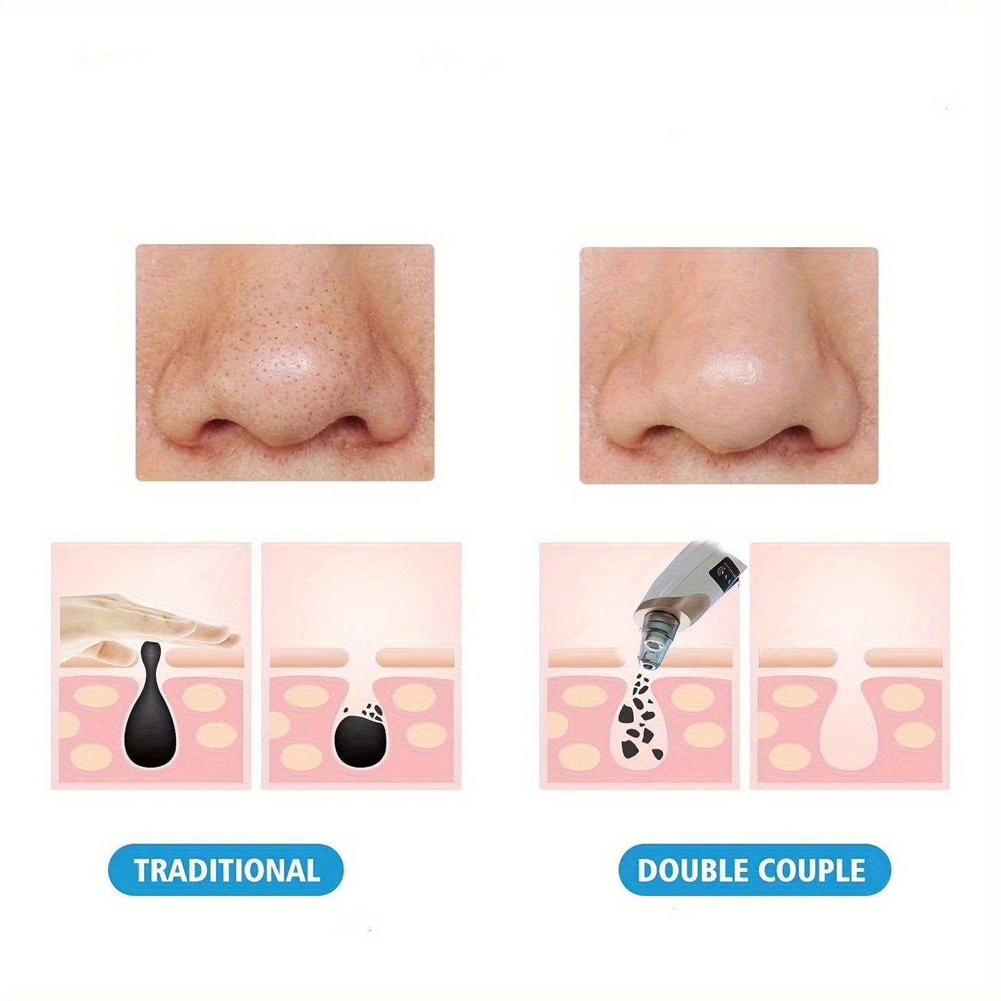 4 in 1 BlackHead Remover 8030 Homzystore